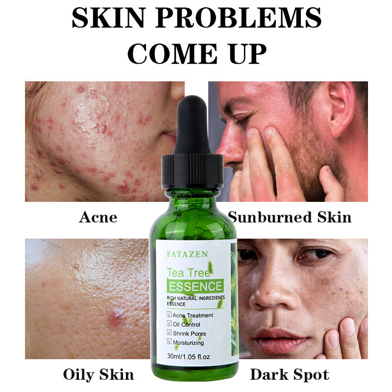 Green Tea Anti-Acne Essence Liquid