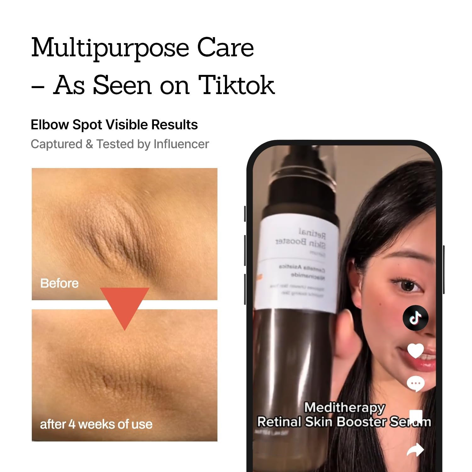 Retinol Skin Booster Serum